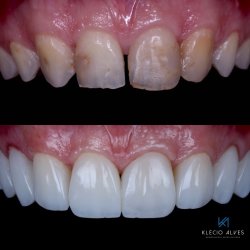 Klecio Alves x Omnia Academy Composite Course