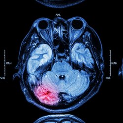 Brain scan image