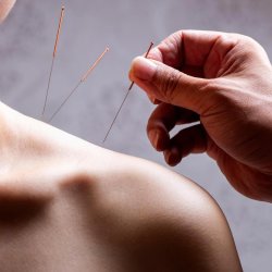Formation - Méthode des 3 Aiguilles du Dr Jin Rui (Jìn Sān Zhēn)