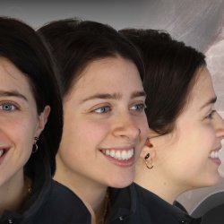 Orthodontic Essentials for General Dentists: Part II