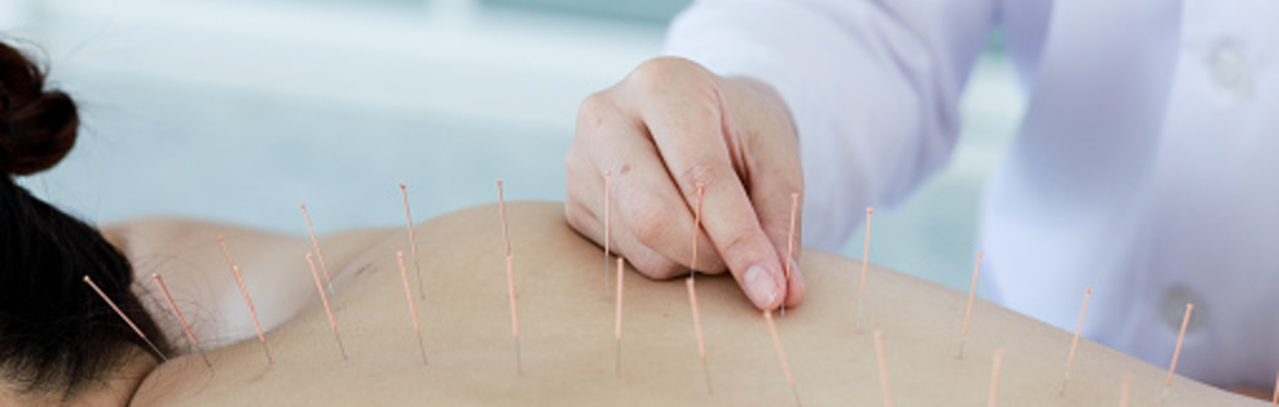 Formation- Acupuncture , Amincissement & Drainage