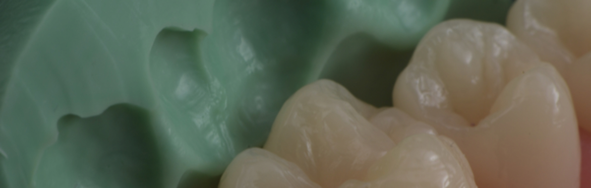 Disruptive Smiles: Sculpt & Layer Posterior Composites with Dr Andrew Chandrapal