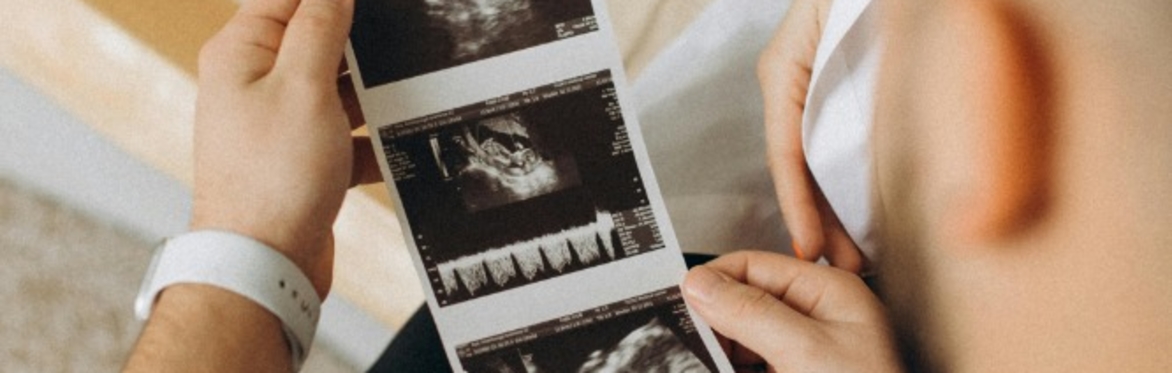 Preparing for birth: how to be an incredible birth partner