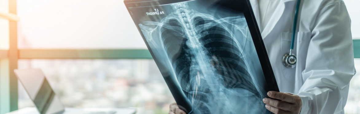 KHP Cardiovascular & Respiratory Partnership Programme's Primary Care Short Course on Chronic Cough