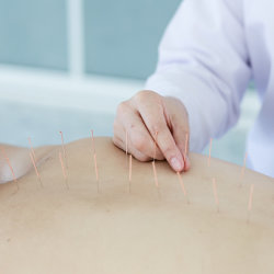 Formation- Acupuncture , Amincissement & Drainage