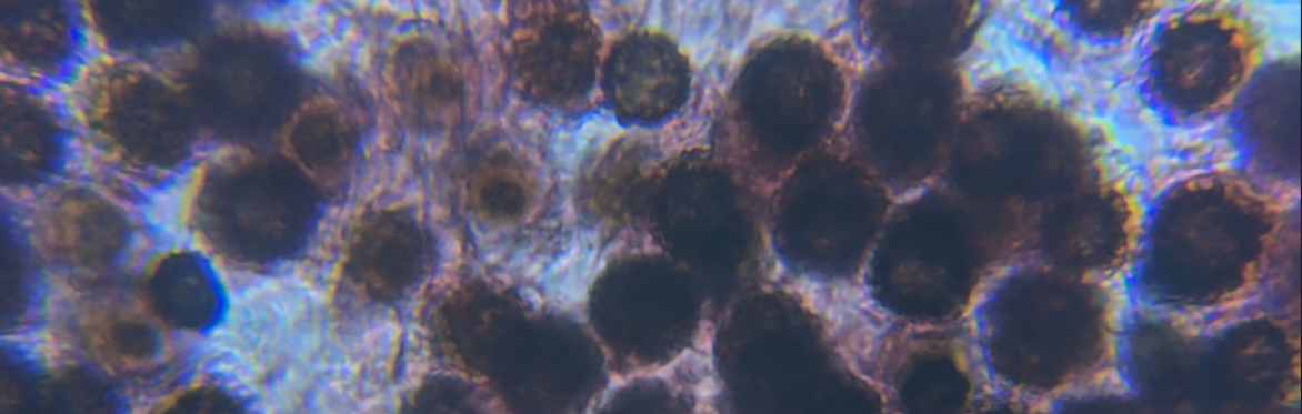a microscopy image of spores.