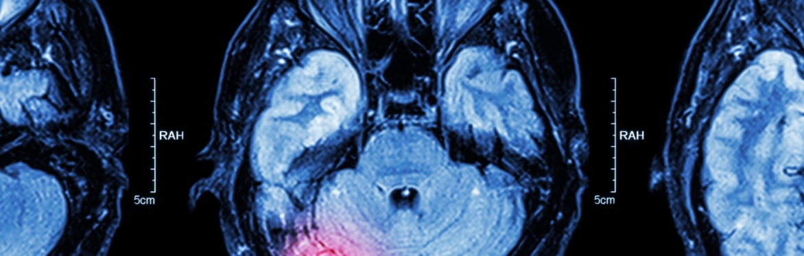Brain scan image