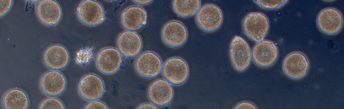 Shellfish Biotechnology Workshop