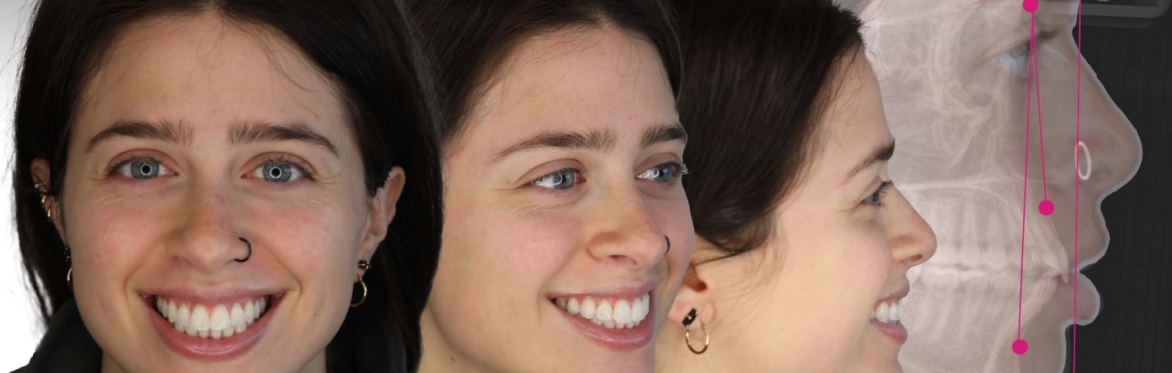 Orthodontic Essentials for General Dentists: Part II