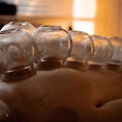 Formation-Pratique des Ventouses Cours avancé