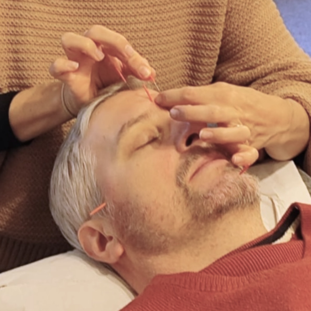 a white male with grey hair receiving a facial acupuncture treatment with several needles in his face