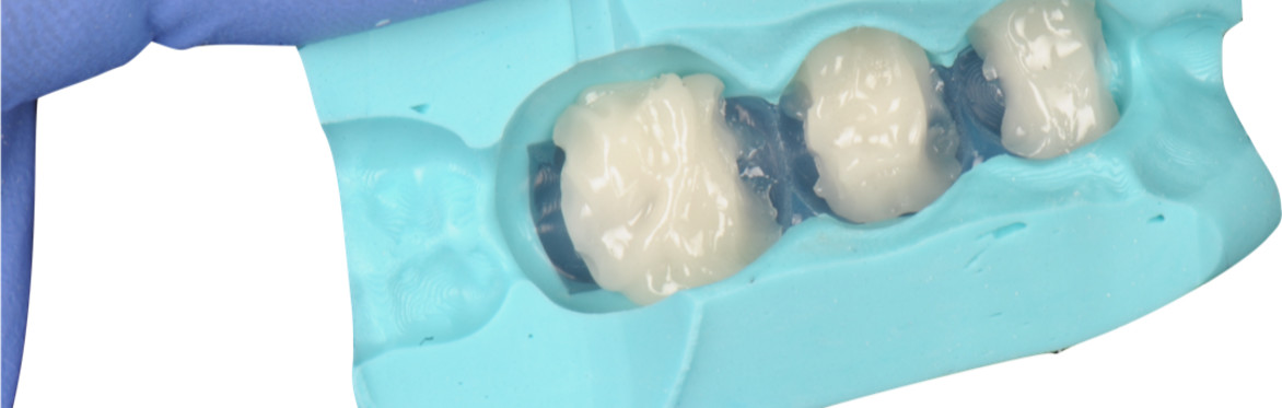 Disruptive Smiles: Sculpt & Layer Posterior Composites with Dr Andrew Chandrapal