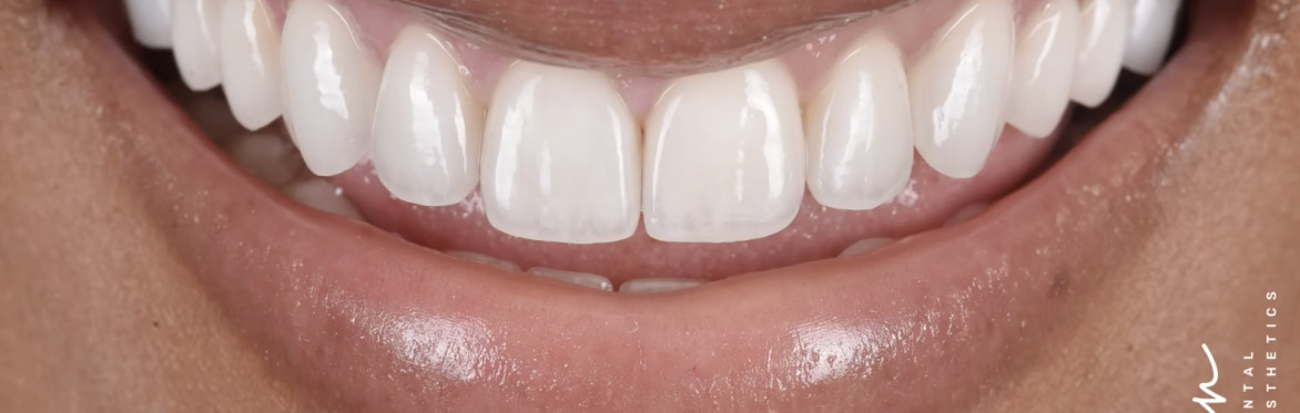 Face Forward: The Power of Facially Driven Aesthetics - Brandon Mack