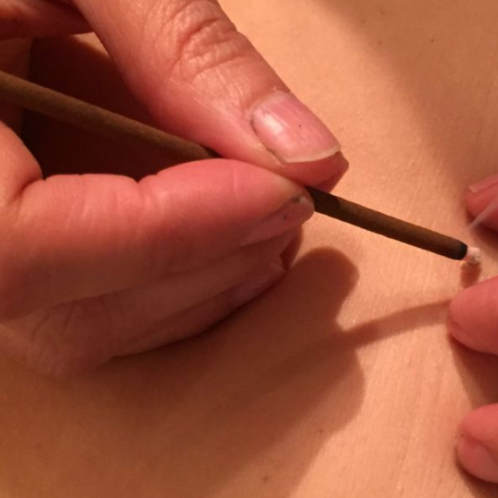 Applying Moxibustion to Root and Branch Treatments with Tony Todd