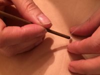 Applying Moxibustion to Root and Branch Treatments with Tony Todd image