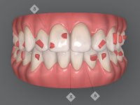 The Complete Aligner Programme USA 2026 image